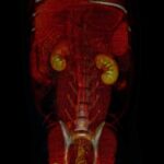 Tomografia-abdomen-veterinaria